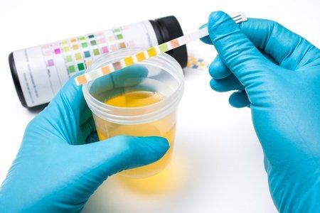 Projeto para análises da urina em doentes oncológicos desenvolvido na Covilhã
