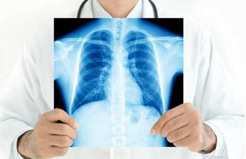  Castelo Branco: ULS alerta para a importância de prevenir Infecções Respiratórias